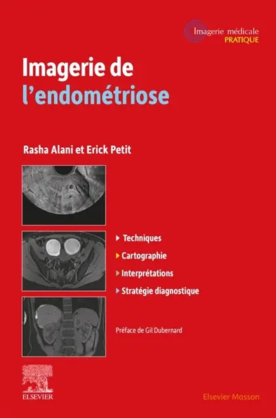 Imagerie de l'endométriose