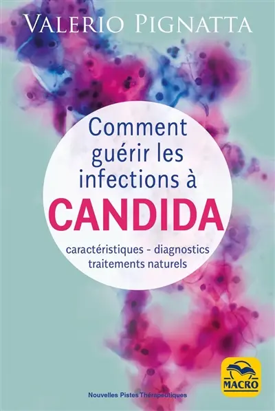 Comment guérir les infections à candida : caractéristiques, diagnostics, traitements naturels