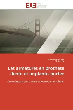 Les armatures en prothese dento et implanto-portee : Contraintes pour la mise en oeuvre et resultats.