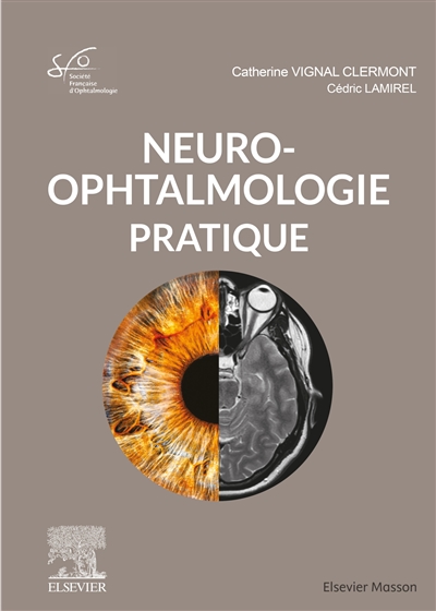Neuro-ophtalmologie pratique : rapport 2020