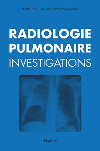 Radiologie pulmonaire : investigations