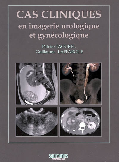 Cas cliniques en imagerie urologique et gynécologique