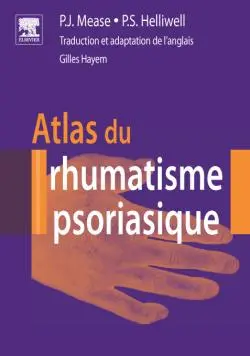 Atlas du rhumatisme psoriasique
