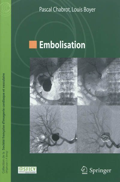 Embolisation