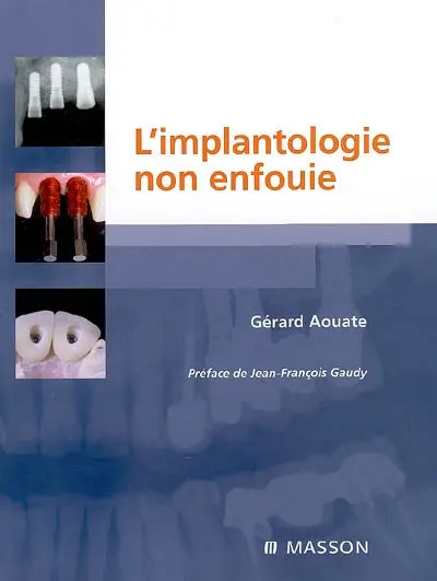 L'implantologie non enfouie