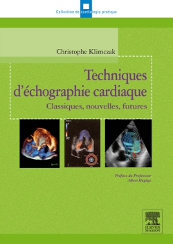 Techniques d'échographie cardiaque : classiques, nouvelles, futures