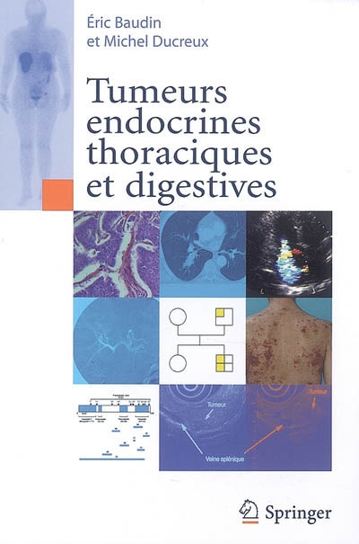 Tumeurs endocrines thoraciques et digestives