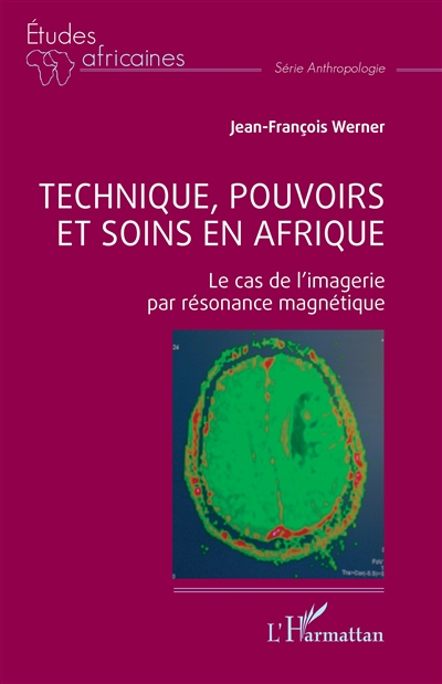 Technique, pouvoirs et soins en Afrique : le cas de l'imagerie par résonance magnétique
