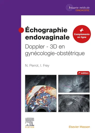 Echographie endovaginale : Doppler 3D en gynécologie-obstétrique