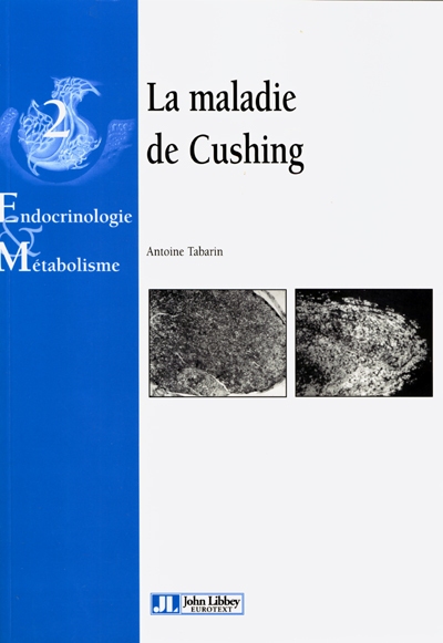 La maladie de Cushing