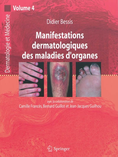 Dermatologie et médecine. Vol. 4. Manifestations dermatologiques des maladies d'organes