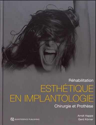 Esthétique en implantologie : réhabilitation : chirurgie et prothèse