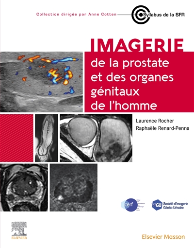 Imagerie de la prostate et...