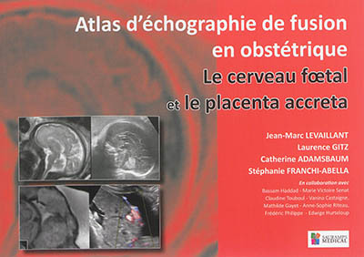 Atlas d'échographie de fusion en obstétrique : le cerveau foetal et le placenta accreta