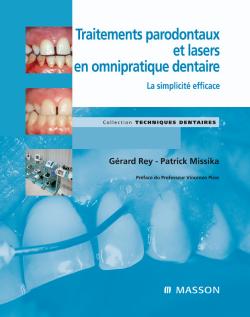 Traitements parodontaux et lasers en omnipratique dentaire : la simplicité efficace