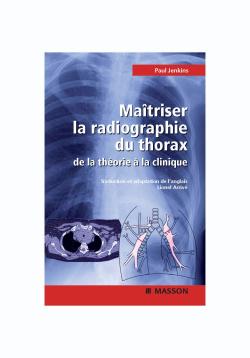 Maîtriser la radiographie du thorax : guide pratique