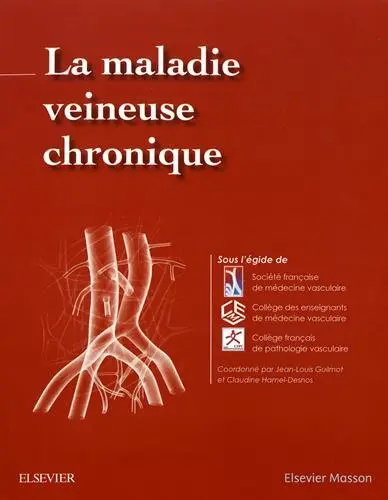 La maladie veineuse chronique