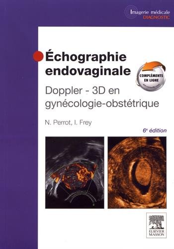 Echographie endovaginale : Doppler 3D en gynécologie-obstétrique