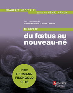 Imagerie du foetus au nouveau-né