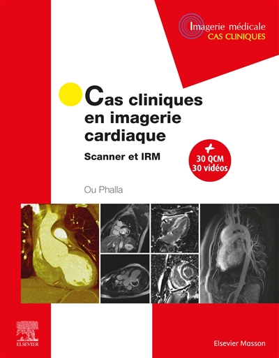 Cas cliniques en imagerie cardiaque : scanner et IRM