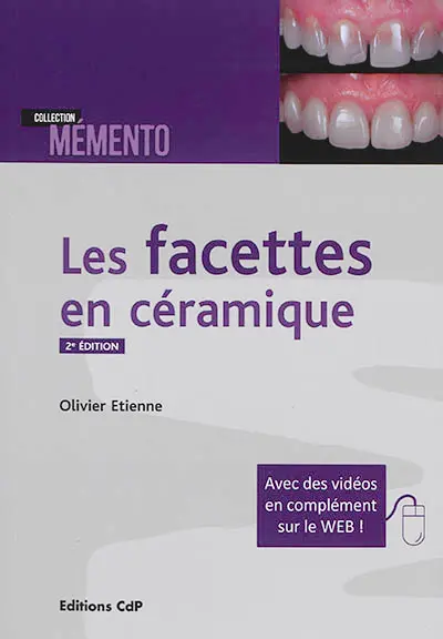 Les facettes en céramique