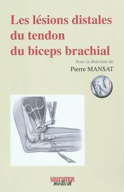 Les lésions distales du tendon du biceps brachial
