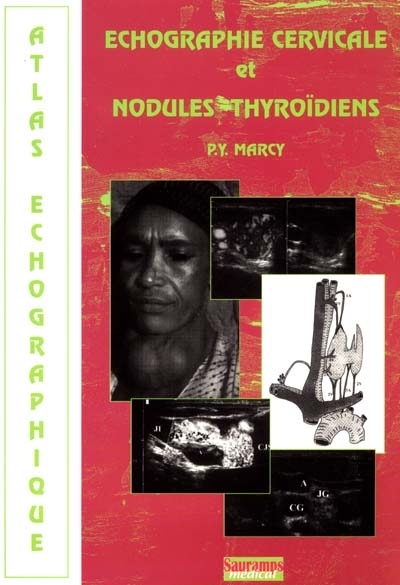 Echographie cervicale et nodules thyroïdiens