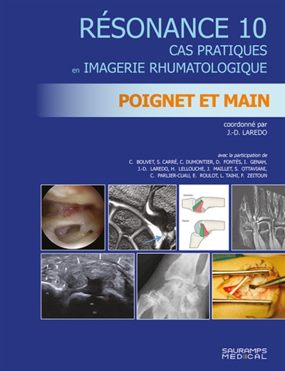 Résonance : cas pratiques en imagerie rhumatologique. Vol. 10. Poignet et main