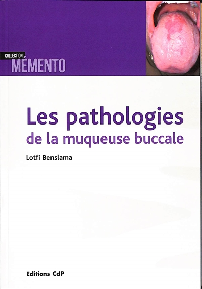 Les pathologies de la muqueuse buccale