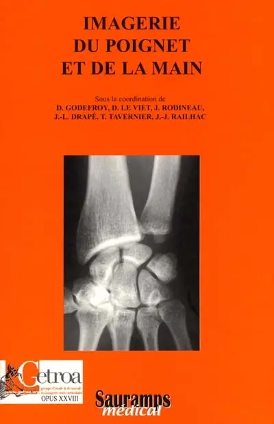 Imagerie du poignet et de la main