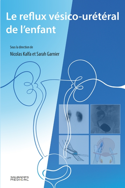 Le reflux vésico-urétéral...