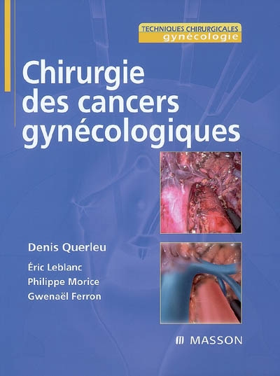 Chirurgie des cancers gynécologiques