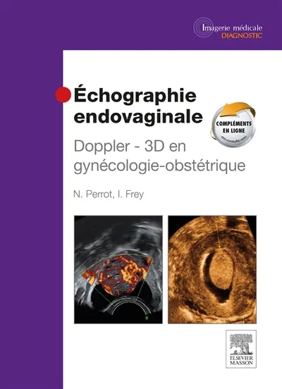 Echographie endovaginale : Doppler 3D en gynécologie-obstétrique
