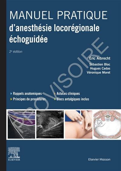 Manuel pratique d'anesthésie locorégionale échoguidée