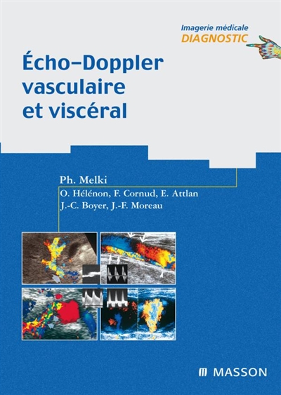Echo-Doppler vasculaire et viscéral
