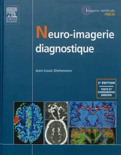 Neuro-imagerie diagnostique