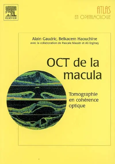 OCT de la macula : tomographie en cohérence optique
