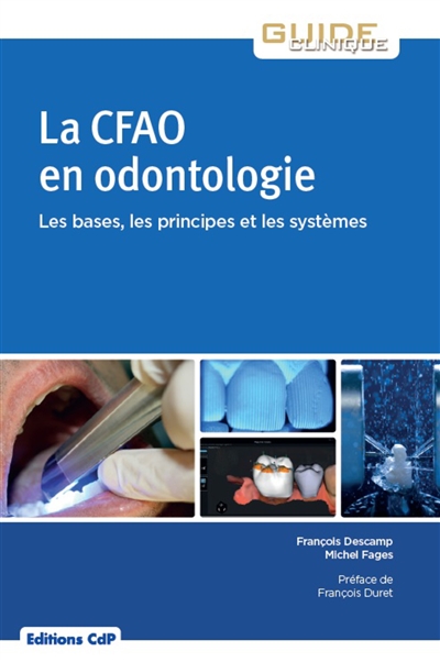 La CFAO en odontologie : les bases, les principes et les systèmes