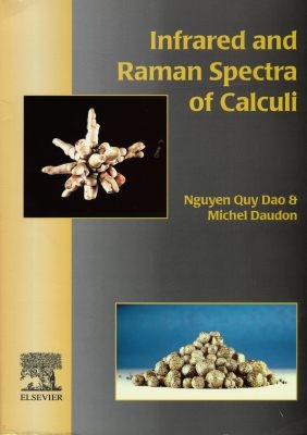 Infrared and raman spectra of calculi