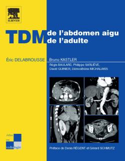 TDM de l'abdomen aigu de l'adulte