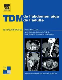 TDM de l'abdomen aigu de l'adulte