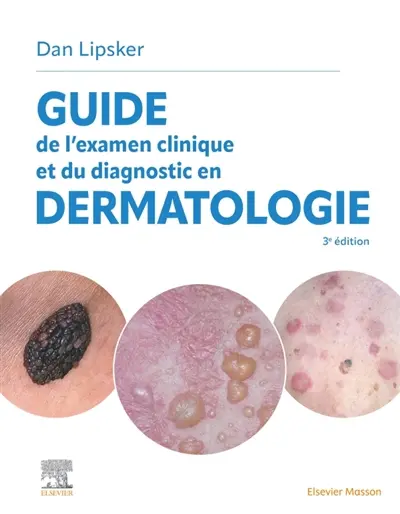 Guide de l'examen clinique et du diagnostic en dermatologie
