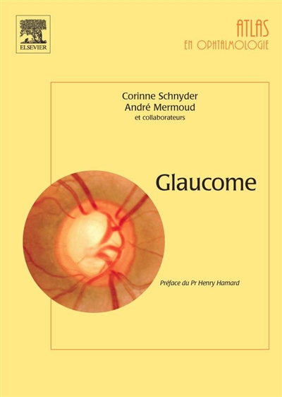 Glaucome