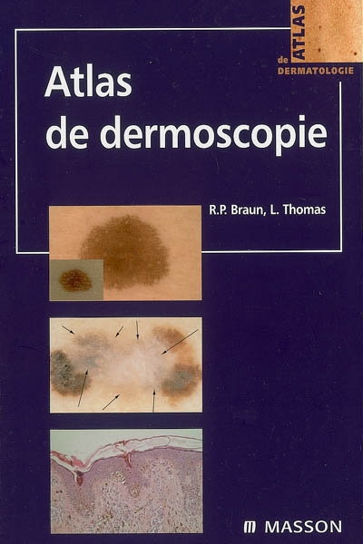 Atlas de dermoscopie