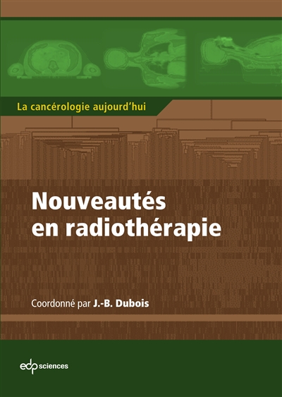 Nouveautés en radiothérapie