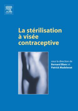 La stérilisation à visée contraceptive