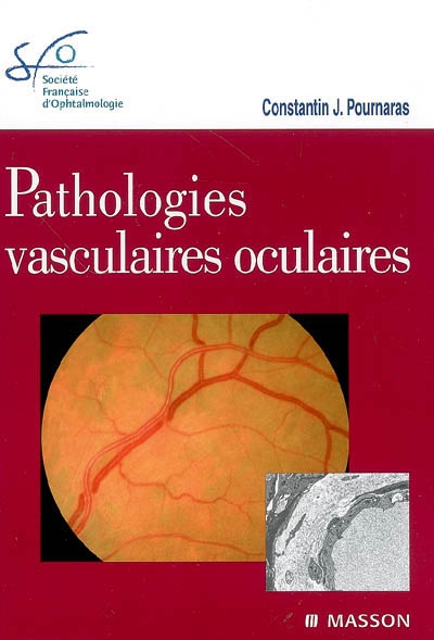 Pathologies vasculaires oculaires : rapport SFO 2008
