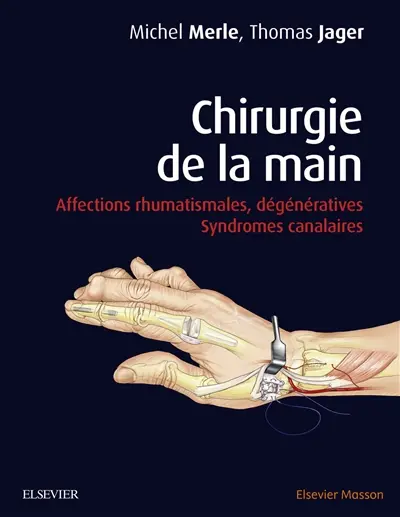 Chirurgie de la main. Affections rhumatismales, dégénératives, syndromes canalaires