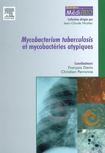 Mycobacterium tuberculosis et mycobactéries atypiques