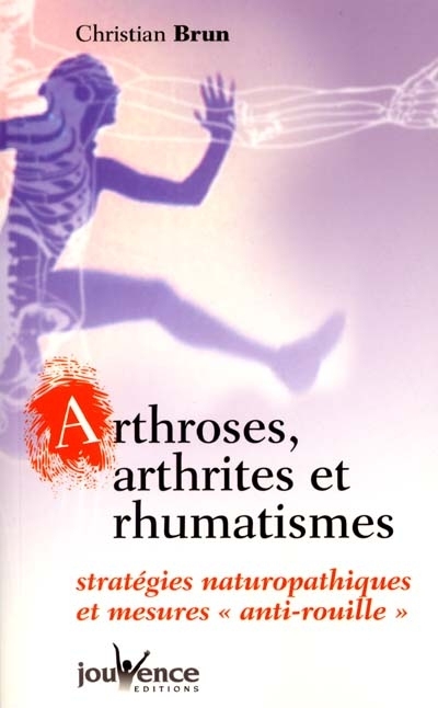 Arthroses, arthrites et rhumatismes : stratégies naturopathiques et mesures anti-rouille